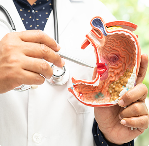 Imagen de endoscopía bariátrica